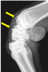 <p>What is the etiology for carpal chip fractures?</p>