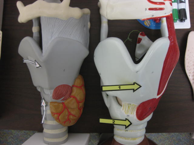 <p>Identify 1, and 2?</p><p>Lab Image 5-4</p>