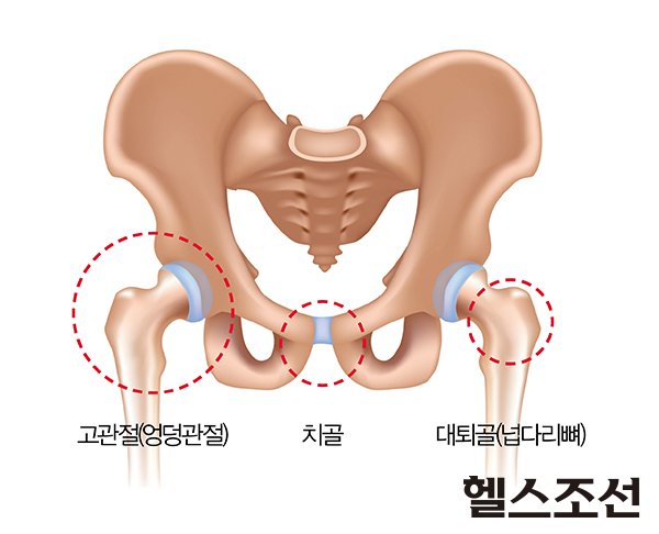 <p>고관절 벌리기 / hip : 고관절(골반과 허벅지뼈가 만나는 관절) / 넓적다리 고(股) / abduction : [æbˈdʌkʃən] 벌림</p>