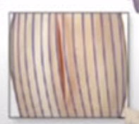 <p>Incisions made _____ to the cleavage lines gape less, lower infection rate and therefore heal faster with less scar formation.</p>