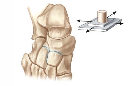 <p>-flat/slightly curved bones</p><p>-biaxial</p><p>-eg; btw tarsals</p>