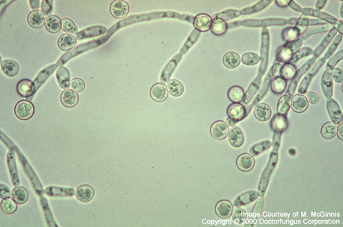 <p>Pseudohyphae</p><p>Clusters of round blastoconidia</p><p>Terminal chlamydospores</p>