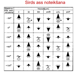 <p>Frontālā plaknē, kambaros.</p><p>Izmanto standarta un pastiprinātos novadījumos.</p><p> TIKAI QRS kompleksu.</p>