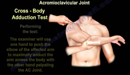 <p><strong>AC joint injury</strong></p><p>patient sitting</p><p>bring arm into horizontal adduction- across neck</p><p>positive if: pain on top of AC joint</p>