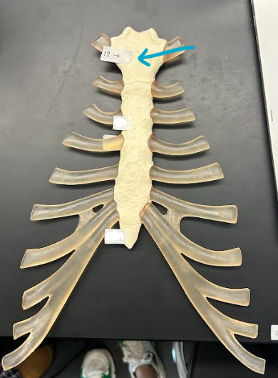 <p>ID sternum/ribs region </p>