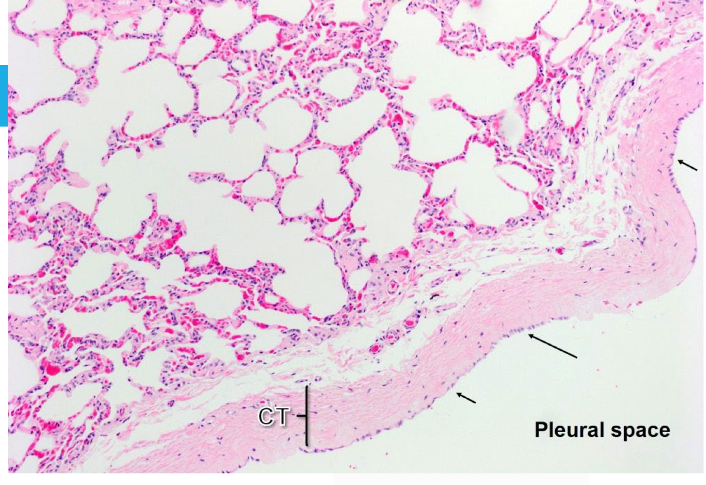 <p>What are the arrows pointing to on this lung histology?</p>