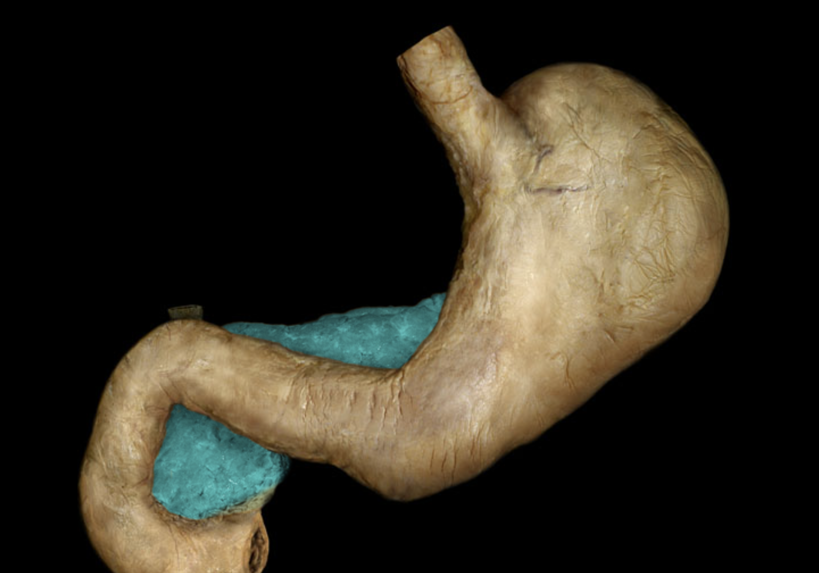 term image