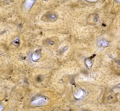 <p>What type of bone is this?</p>