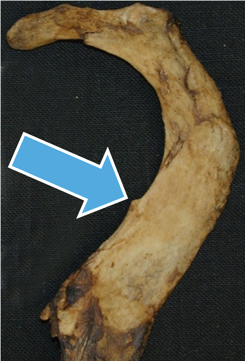 <p>Feature of the first rib</p>