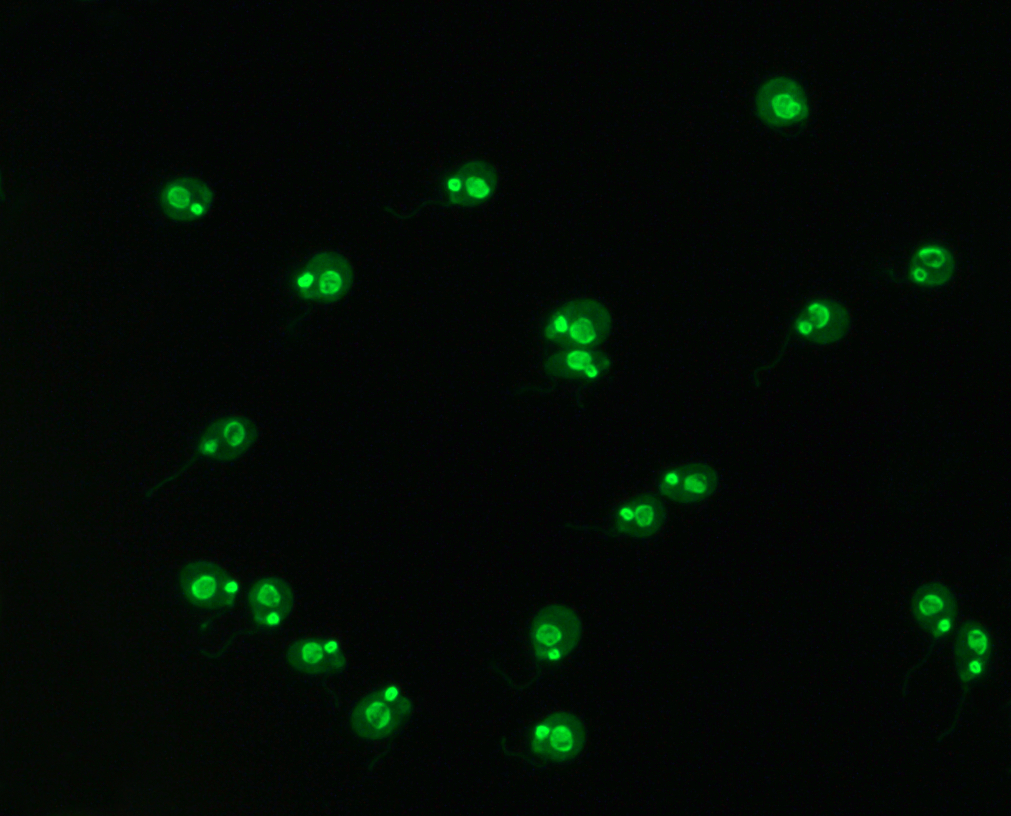 <p>Positive: Fluorescence of kinetoplast → large chunky glow (homogeneous)</p><p>Negative: no fluorescence</p>