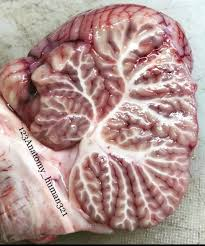 <p>The little tree in the cerebellum </p>