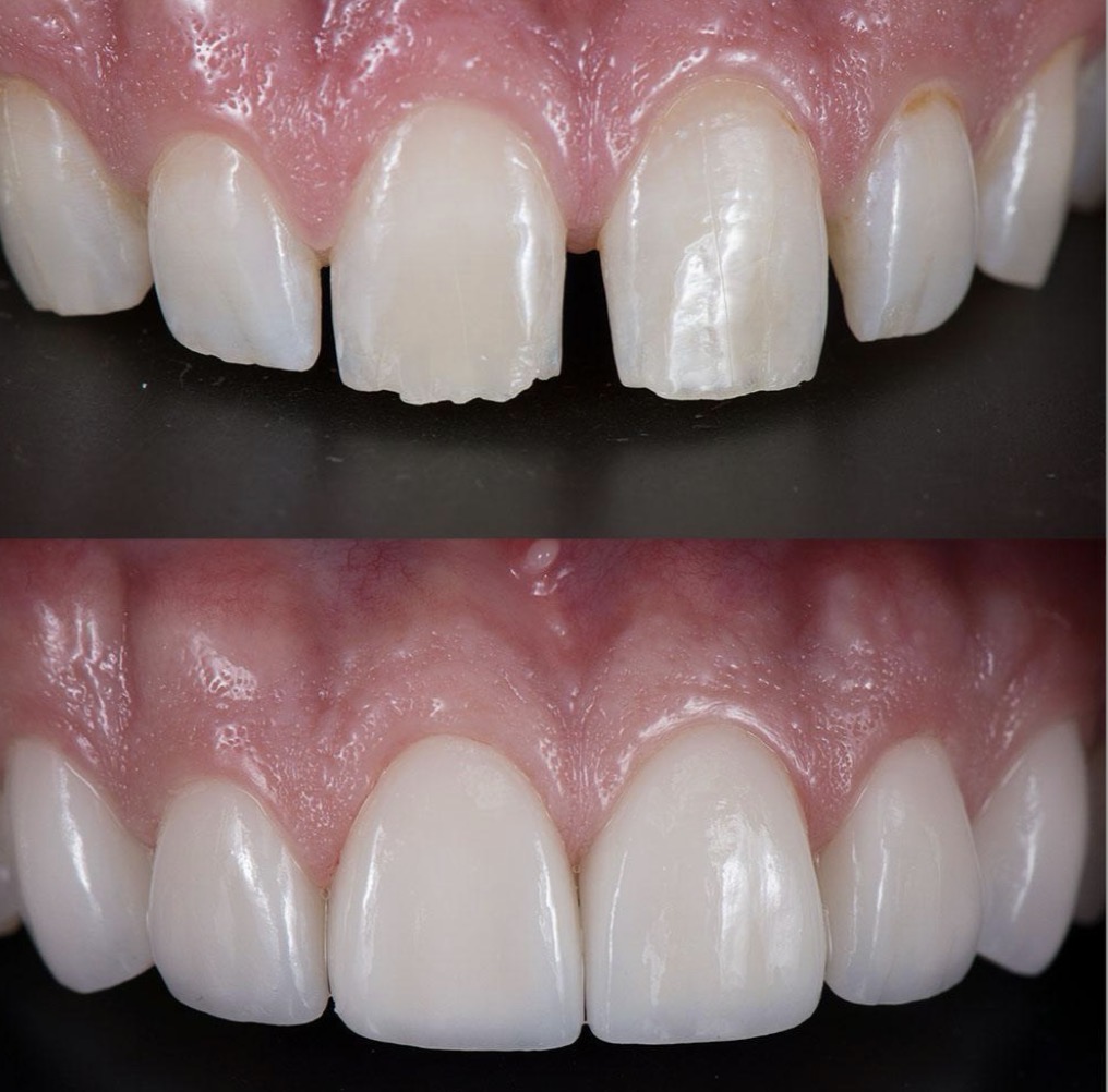 <p>What dental specialty is being displayed here?</p>