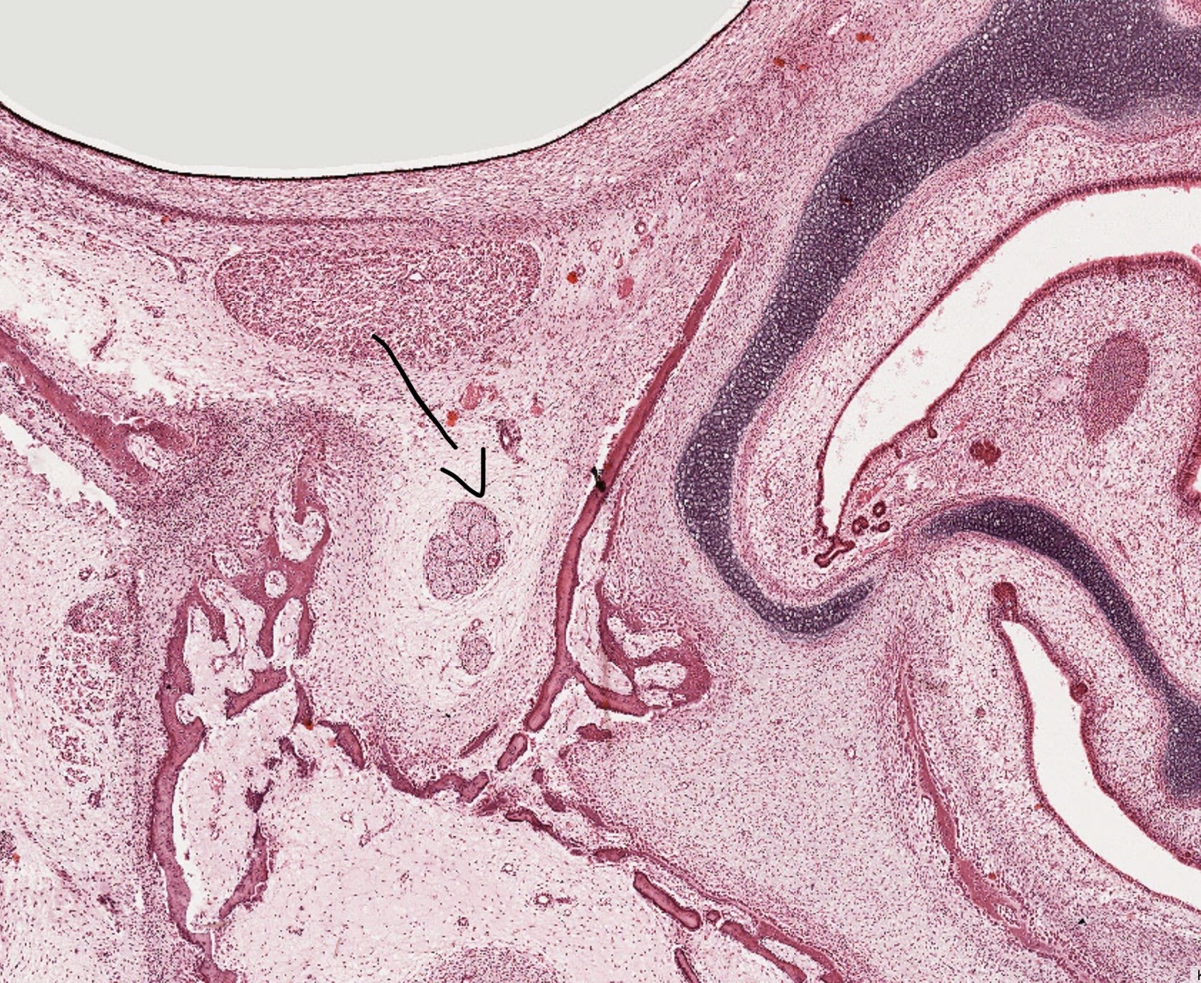 term image