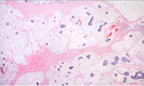 <p>What pathology?</p>