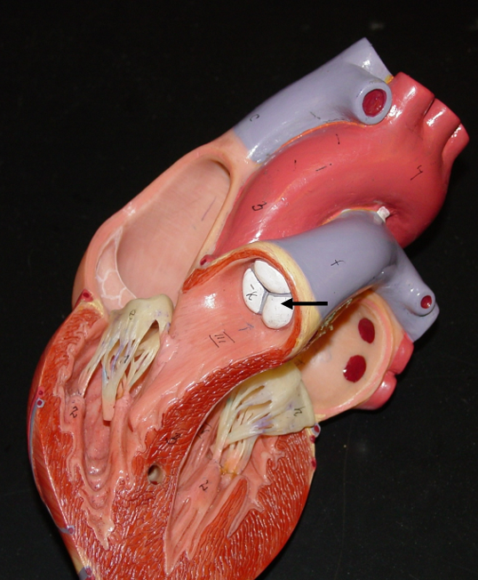 <p>Directs from from the right ventricle to the Pulmonary trunk</p>