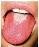 term image