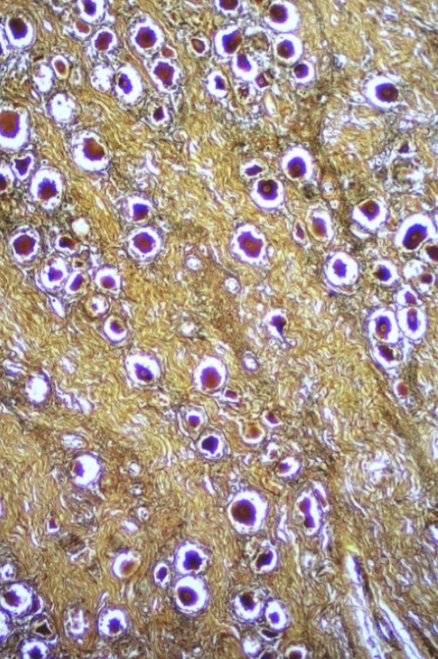 <p>What type of neuron?</p>