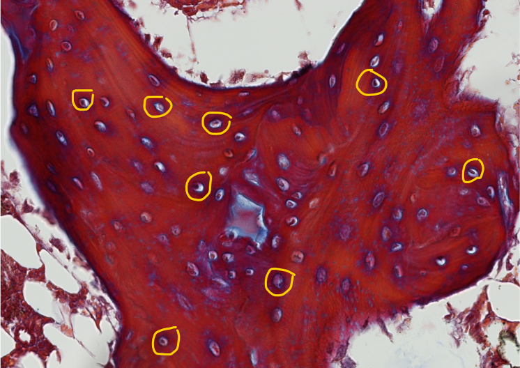 <p><span style="font-family: "Calibri Light";">ID the encircled structures in this bone spicule.</span></p>