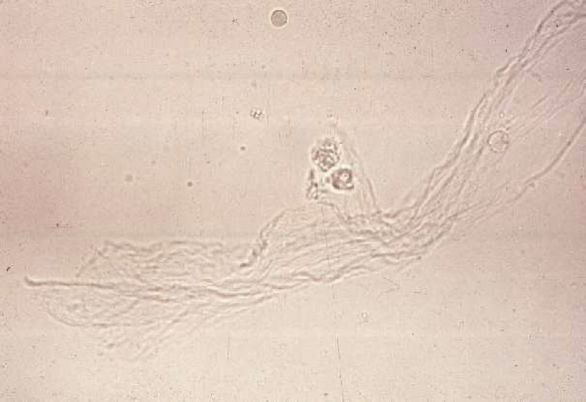 <ul><li><p>Often confused with casts.</p></li><li><p>Resemble a twisted ribbon.</p></li><li><p>A large amount is normal in equine.</p></li><li><p>In other animals, their presence indicates urethral irritation or contamination of the sample with genital secretions.</p></li></ul><p></p>