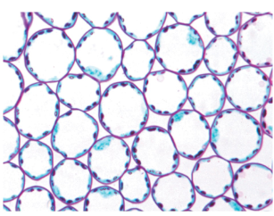 <ul><li><p>Mature parenchyma cells: have thin and flexible primary walls. Cellulose, other sugars, and proteins</p></li><li><p>Lack secondary walls (primary walls + lignin)</p></li><li><p>Are the least specialized. Performs metabolic functions. Retains the ability to divide and differentiate</p></li><li><p>Little dots within cells are chloroplasts</p></li><li><p>Alive</p></li></ul><p></p>