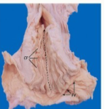 <p>Which species cervix is this?</p>