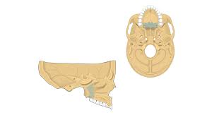 Which bone is this?