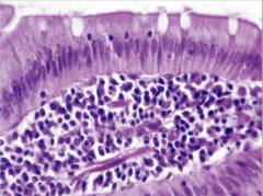 <p>What does this image show?</p>