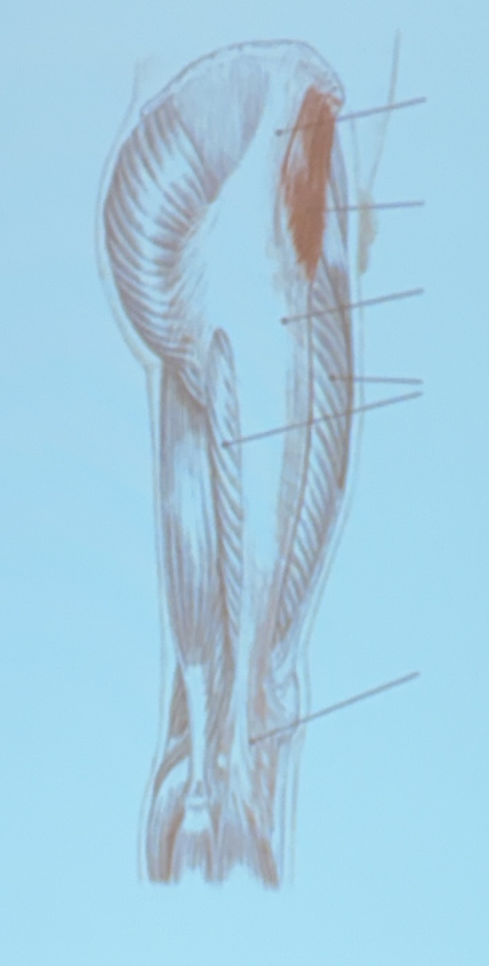 <p>Muscle name?</p>
