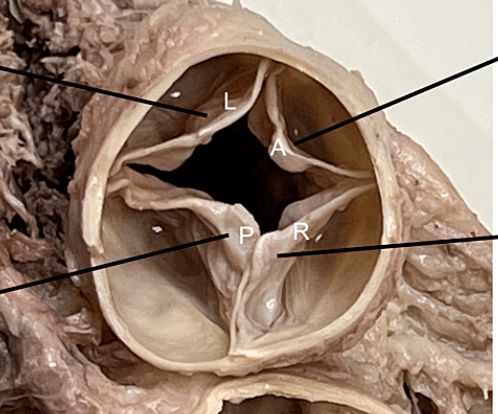 <p>space </p><p>inside large hole on the non apex side of the heart</p>