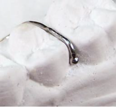 <p>ID the type of clasp:</p>