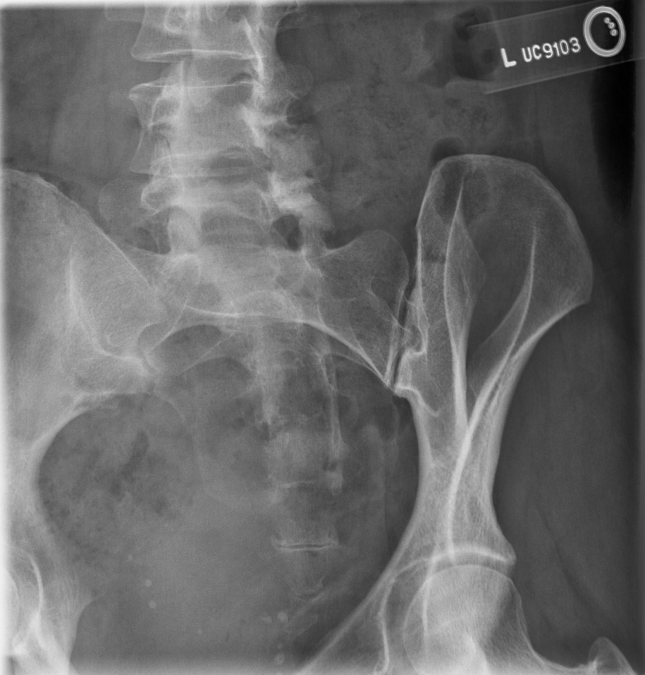 <p>critique this Oblique SI joints</p>