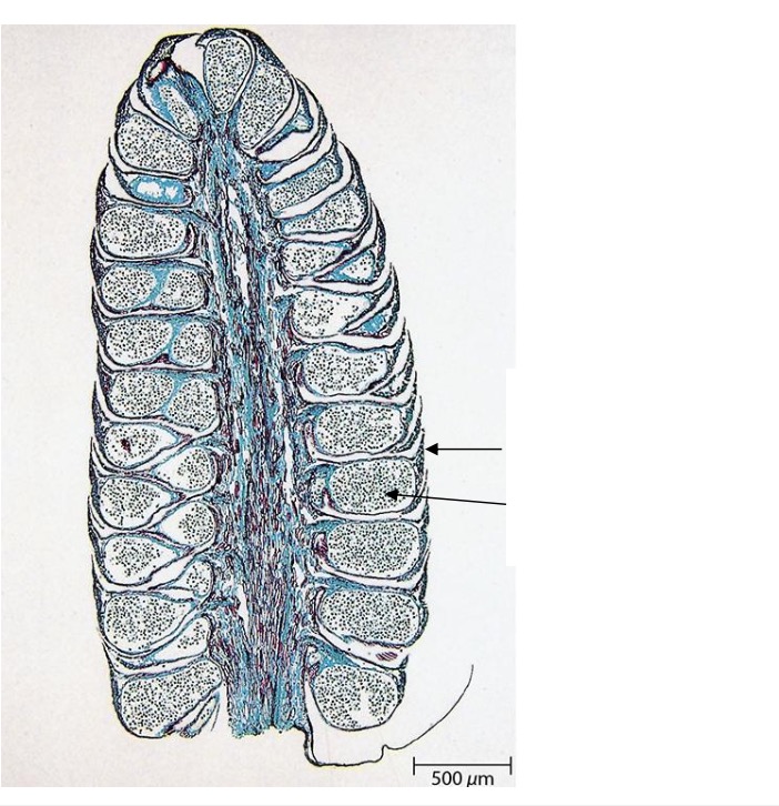 <p>Label the structures of a male cone. </p>