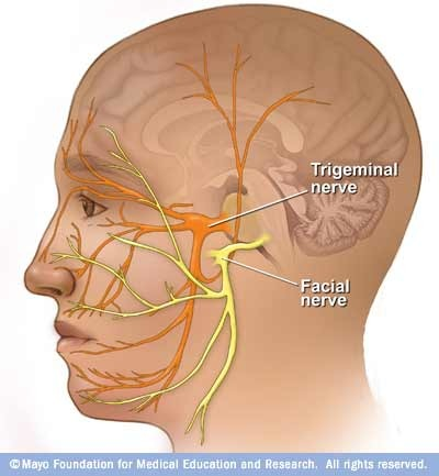 <p>Facial (XII)</p>
