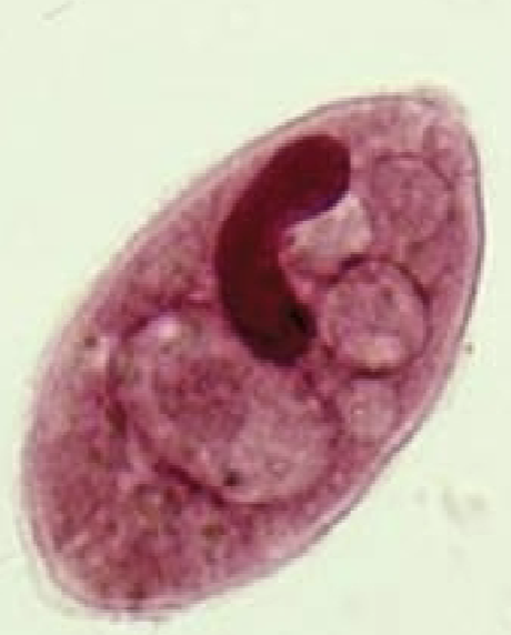 <p>What protist is this?</p>