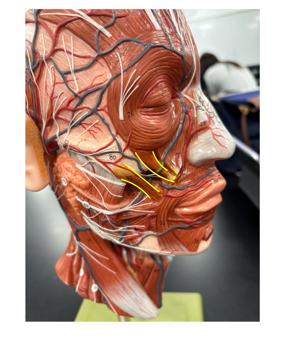 <p>name the muscle and its antagonist </p>