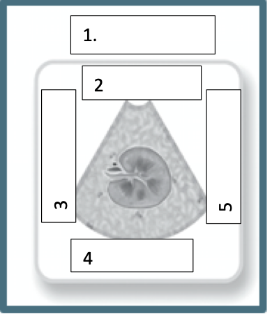 <p>Label this</p>
