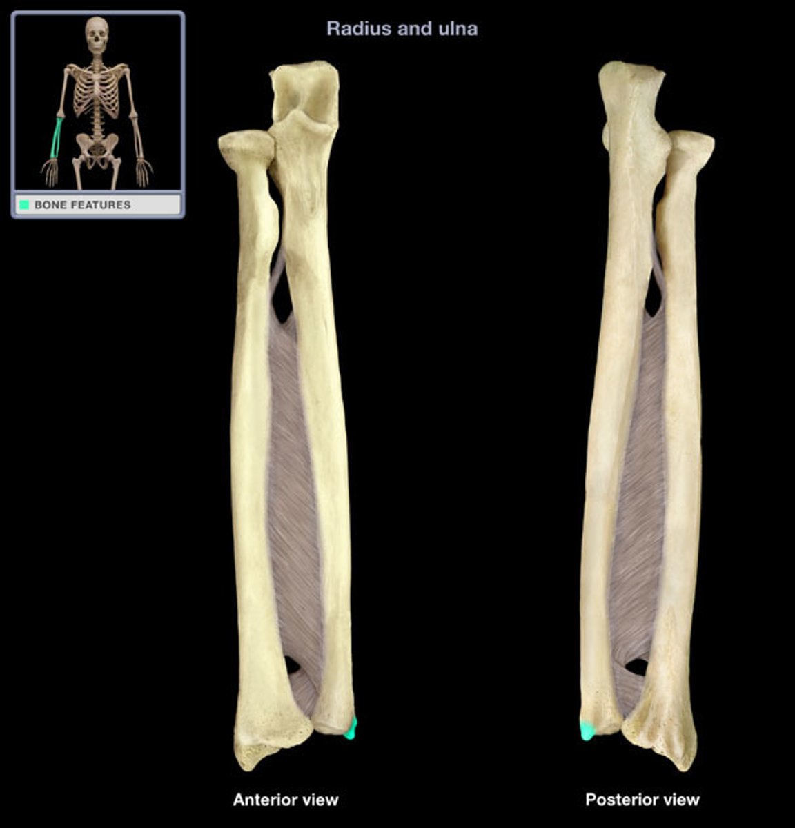 <p>(what bone and bone marking)</p>