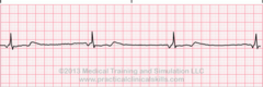 <p>identify the rhythm</p>
