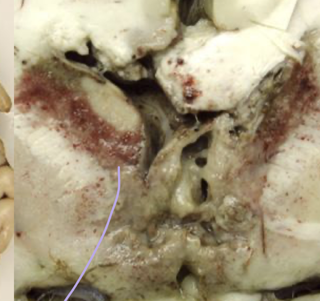 <p>What condition is this?</p>