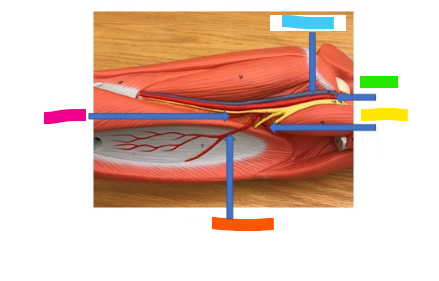 <p>What is the pink arrow?</p>