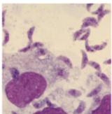 <p>causes toxoplasmosis</p><ul><li><p>associated with cats → litter box</p></li><li><p>affects pregnant women → pass to fetus</p><ul><li><p>this pathogen can cross the placenta and infect the fetus in the womb </p></li></ul></li><li><p>affects immunocompromised individuals (eating undercooked beef)</p><ul><li><p>affects brain (causes hemolytic process → bleeding and dementia); identify by brain biopsy</p></li></ul></li></ul><p></p>