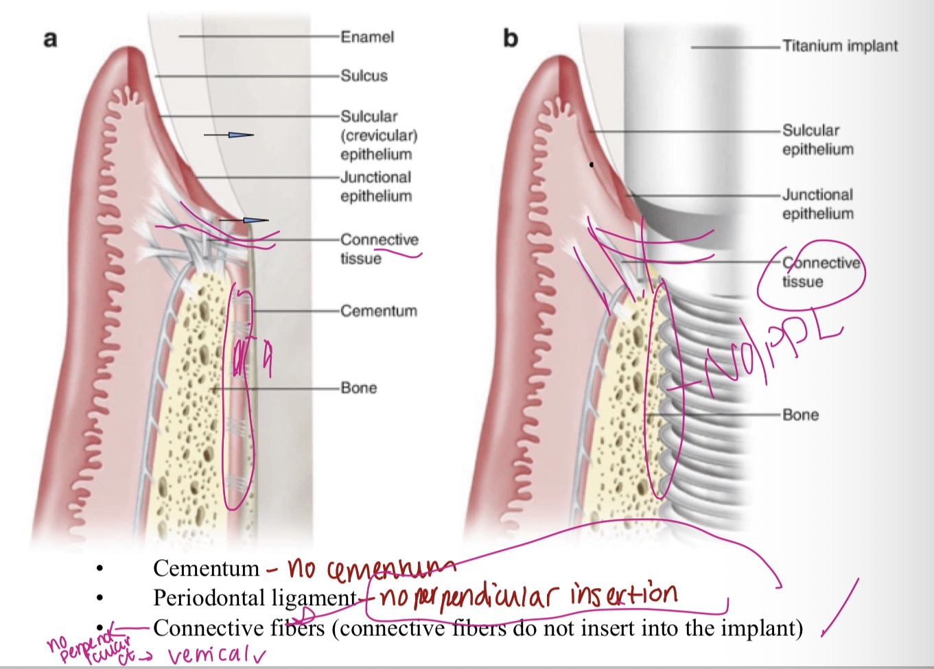 <p>No cementum </p><p>No PDL </p><p>No perpendicular ct, only vertical</p>