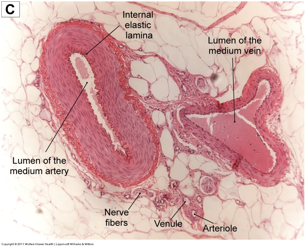 <p>pink: medium artery</p><p>green: medium vein</p>