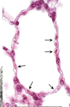 <p>What are those arrows pointing to?</p>