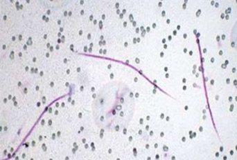 <p>Dirofilaria</p>