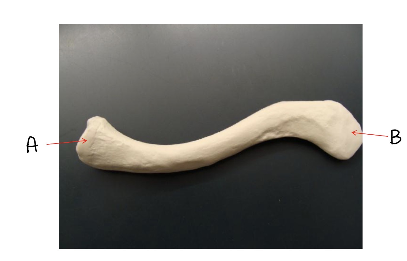 <p>What bone is this? (Name left or right, the anatomical view, and A-B)</p>