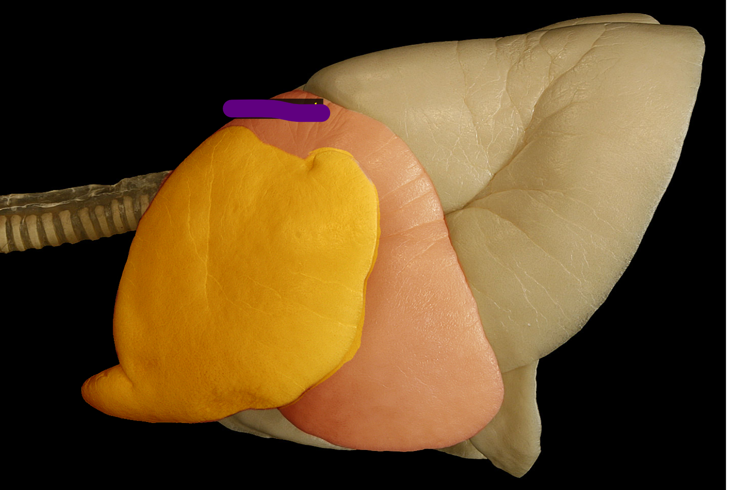 <p>name the structures, yellow, red, and tan , be full and complete</p>