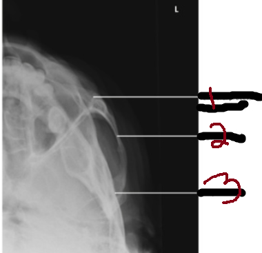 <p>3</p>