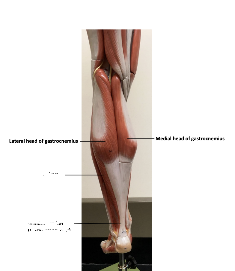 <p>Gastrocnemius</p>