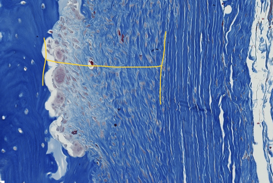 <p>in actively growing bone, the periosteum has 2 visible layers. ID the layer within the yellow bracketed portion.</p>